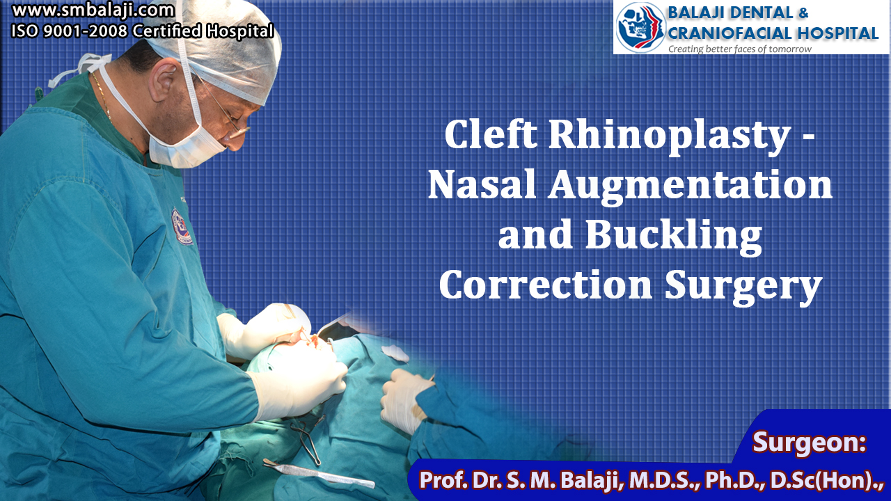 Cleft Rhinoplasty - Nasal Augmentation and Buckling Correction Surgery