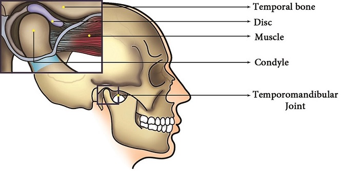 Tm Joint Surgery In India