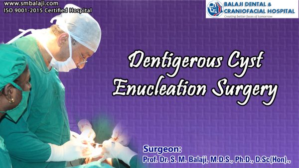 Dentigerous Cyst Enucleation Surgery