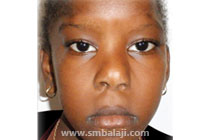 Craniofacial Deformities 23 After Surgery