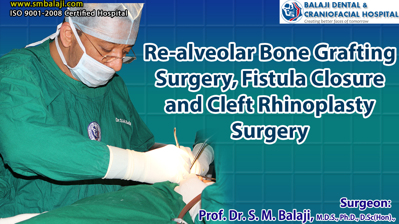 Re-alveolar bone graft Surgery, Fistula Closure and Cleft Rhinoplasty Surgery