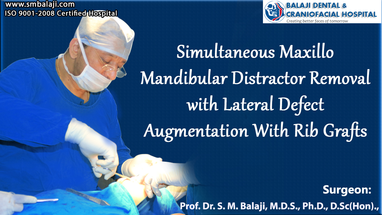 Simultaneous Maxillo Mandibular Distractor Removal with Lateral Defect Augmentation With Rib Grafts