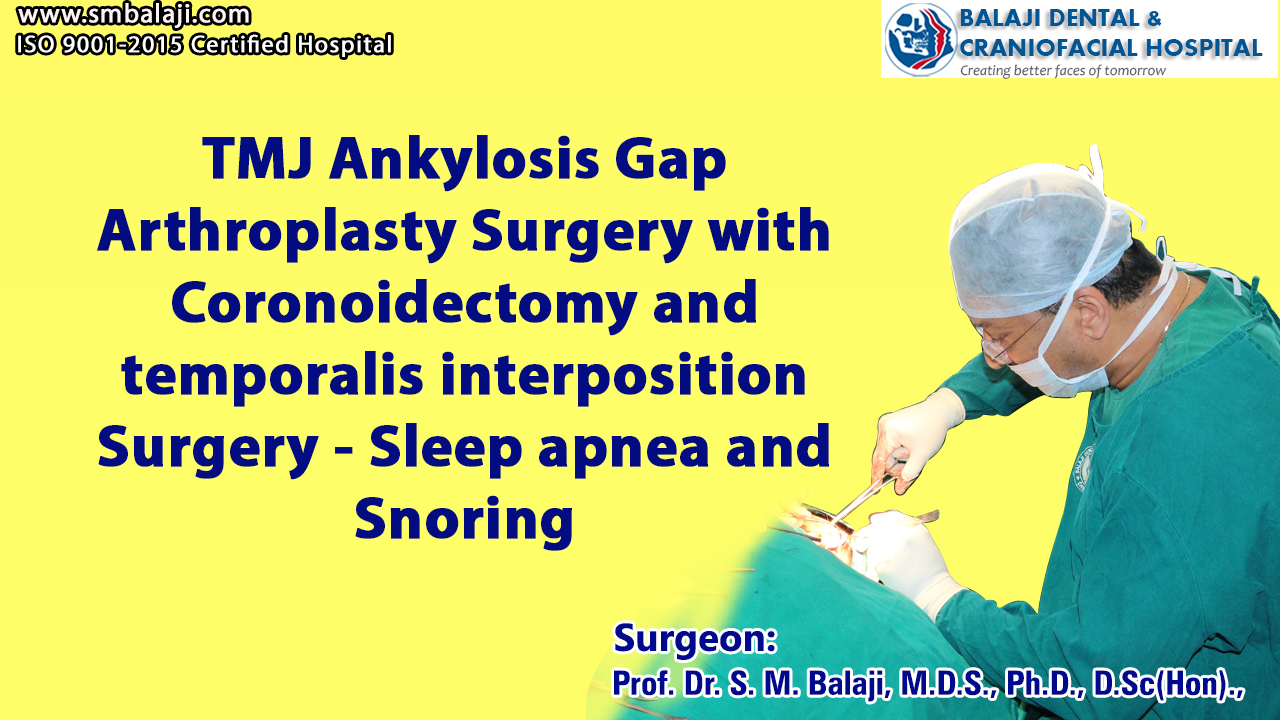 TMJ Ankylosis Gap Arthroplasty Surgery with Coronoidectomy and temporalis interposition Surgery - Sleep apnea and Snoring