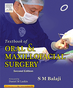 Textbook Of Oral And Maxillofacial Surgery