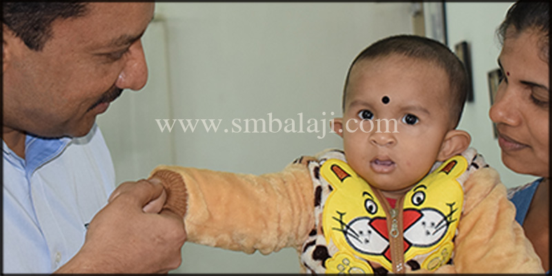 Following 9 months after cleft lip repair surgery showing enhanced appearance of the boy