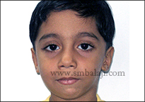 TMJ Trauma 15 Defect Correct Following Surgery