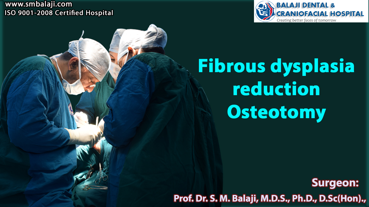 Fibrous dysplasia reduction Osteotomy
