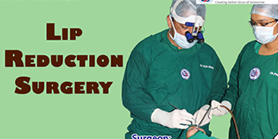 Lip Reduction Surgery – Dr. S.M Balaji, Balaji Dental and Craniofacial Hospital