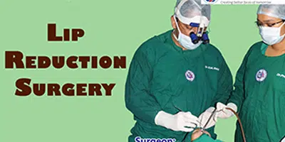 Lip Reduction Surgery
