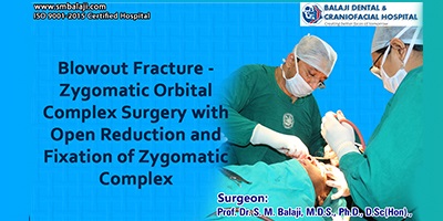 Blowout Fracture – Zygomatic Orbital Complex Surgery with Open Reduction and Fixation of Zygomatic Complex