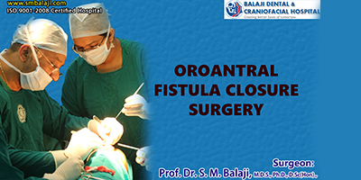 Oroantral Fistula Closure Surgery