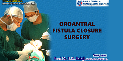 Oroantral Fistula Closure Surgery – Dr SM Balaji, Oral and Maxillofacial Surgeon, India