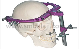 Types of Distraction Osteogenesis 2 Rigid External Distractor (Red)