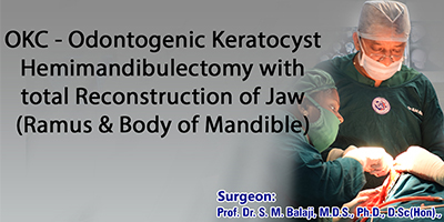 OKC – Odontogenic Keratocyst Hemimandibulectomy with total Reconstruction of Jaw (Ramus & Body of Mandible)