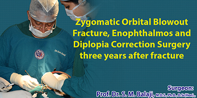 Zygomatic Orbital Blowout Fracture, Trauma care in Chennai India