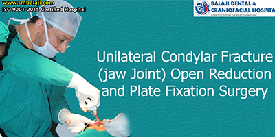 Unilateral Condylar Fracture (jaw Joint) Open Reduction and Plate Fixation Surgery