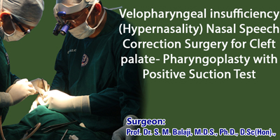 Velopharyngeal insufficiency (Hypernasality) Nasal Speech Correction Surgery for Cleft Palate- Pharyngoplasty with positive suction test