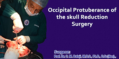 Occipital Protuberance of the skull Reduction Surgery