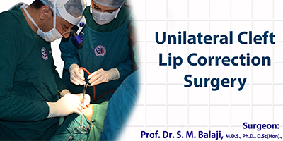 Unilateral cleft lip correction surgery