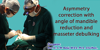 Asymmetry correction with angle of mandible reduction and masseter debulking surgery
