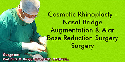 Cosmetic Rhinoplasty - Nasal Bridge Augmentation & Alar Base Reduction Surgery