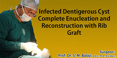 Infected Dentigerous Cyst, Complete Enucleation and Reconstruction with Rib Graft