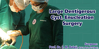 Large Dentigerous Cyst Enucleation Surgery