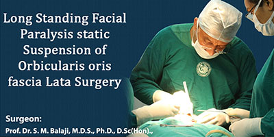 Long standing facial paralysis static suspension of orbicularis oris fascia Lata Surgery