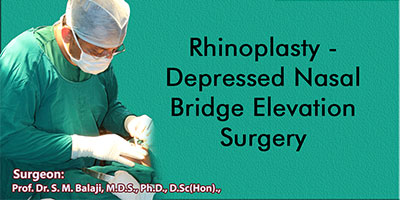 Rhinoplasty - Depressed Nasal Bridge Elevation Surgery
