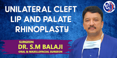 Unilateral cleft lip and palate Rhinoplasty