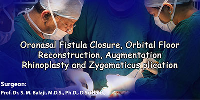 Oronasal Fistula Closure, Orbital Floor Reconstruction, Augmentation Rhinoplasty and Zygomaticus plication