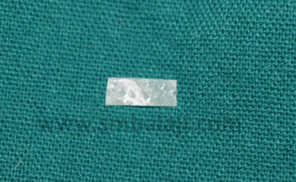 Furcation Defect 4 Gtr Membrane Of Appropriate Size Measured And Trimmed
