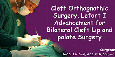 Cleft Orthognathic Surgery, Lefort I Advancement for Bilateral Cleft Lip and palate Surgery