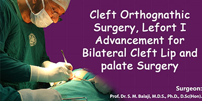 Cleft Orthognathic Surgery, LeFort I Advancement for Bilateral Cleft Lip and palate Surgery