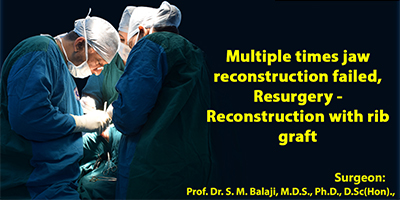 Multiple times jaw reconstruction failed, Resurgery - Reconstruction with rib graft