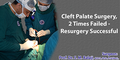 world renowned cleft lip and palate surgeon