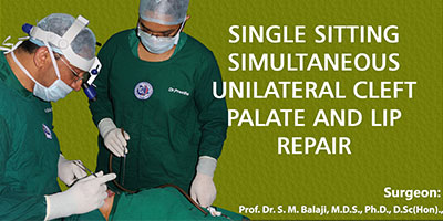 Single sitting simultaneous unilateral cleft palate and lip repair