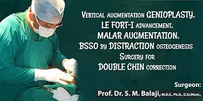 Vertical Augmentation Genioplasty Le Fort 1 Advancement