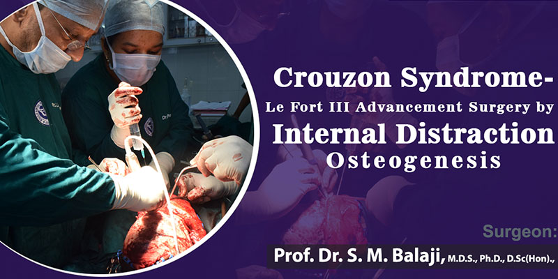 Crouzon Syndrome – Le Fort III Advancement Surgery by Internal Distraction Osteogenesis