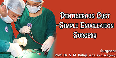 Dentigerous Cyst -Simple Enucleation Surgery