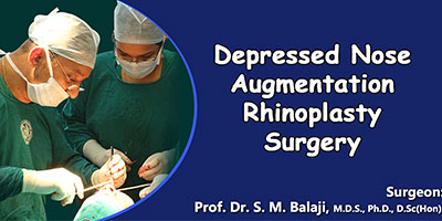 Depressed Nose Augmentation Rhinoplasty Surgery