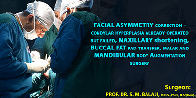 Facial asymmetry correction-- condylar hyperplasia already operated but failed, maxillary shortening, buccal fat pad transfer, malar and mandibular body augmentation surgery