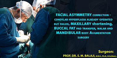 Facial asymmetry correction- condylar hyperplasia already operated but failed, maxillary shortening, buccal fat pad transfer, malar and mandibular body augmentation surgery