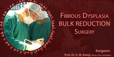 Fibrous Dysplasia Bulk Reduction Surgery