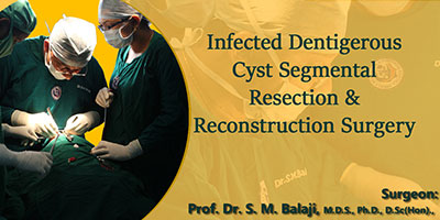 Infected dentigerous cyst-Segmental Resection & Reconstruction Surgery