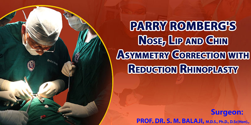 Parry Romberg's Nose Lip and Chin Asymmetry Correction with Reduction Rhinoplasty