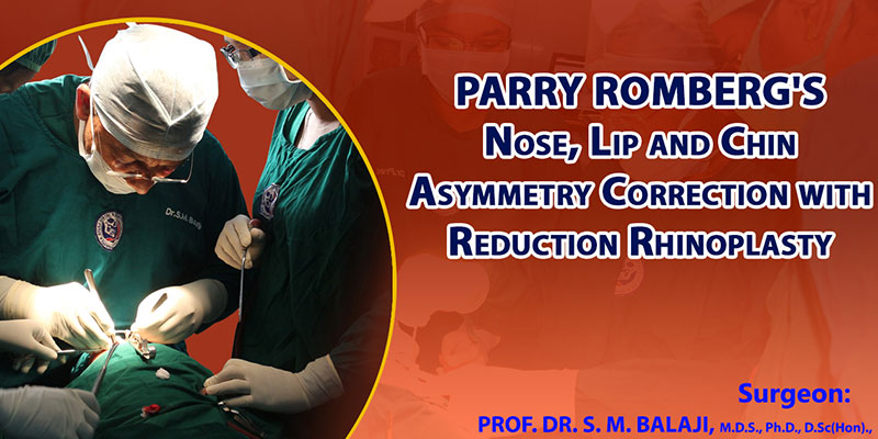 Parry Romberg’s Nose Lip and Chin Asymmetry Correction with Reduction Rhinoplasty