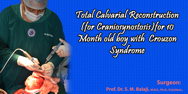 Total Calvarial Reconstruction (for Craniosynostosis)for 10 Month old baby with Crouzon Syndrome