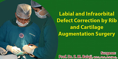 Maxillary augmentation, nasal notch correction and alar web correction surgery