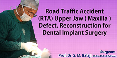 Road Traffic Accident (RTA) Upper Jaw ( Maxilla ) defect, Reconstruction for dental implant surgery
